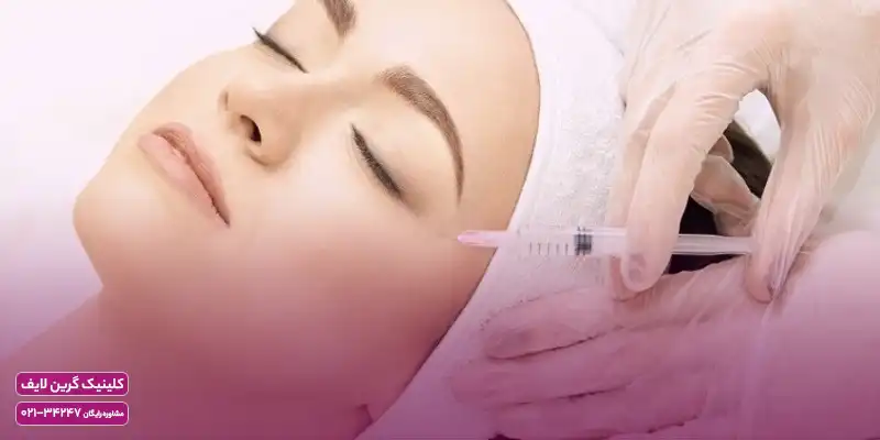 مزوتراپی صورت