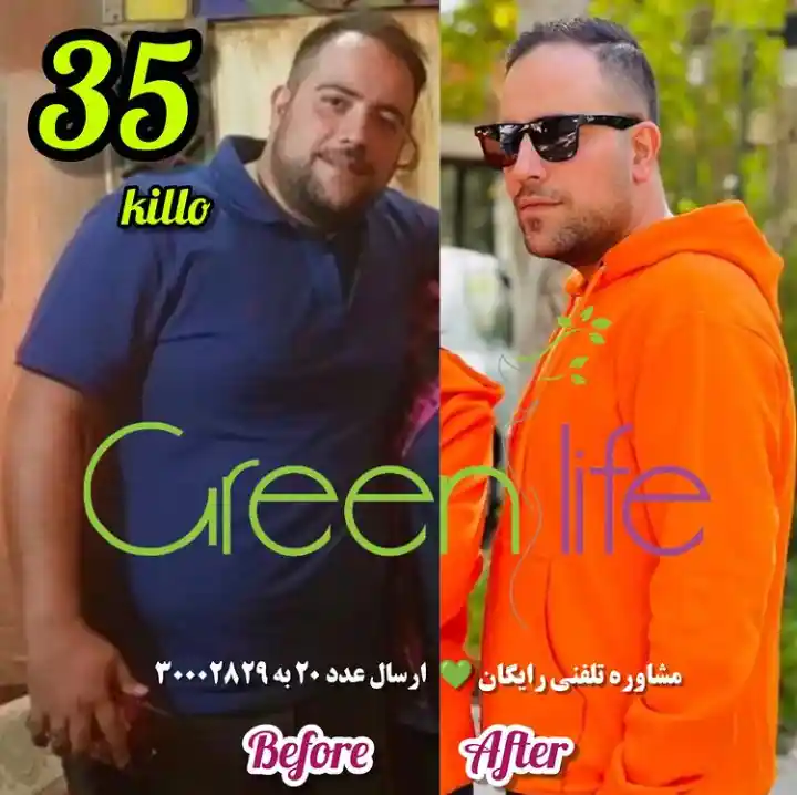 لاغری با دستگاه