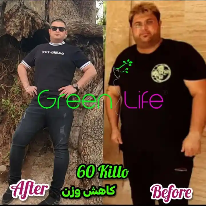 لاغری با دستگاه